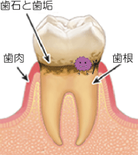 歯茎のこと