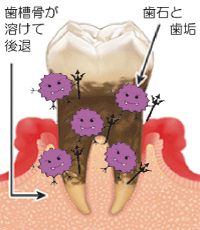 歯茎のこと